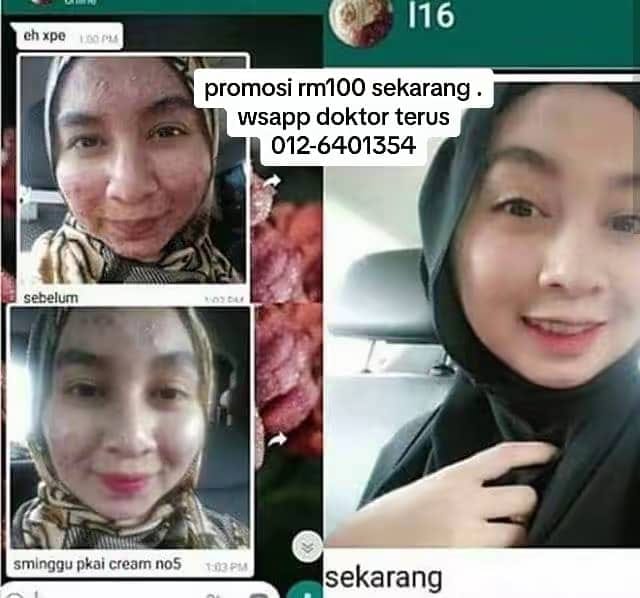 Testimoni